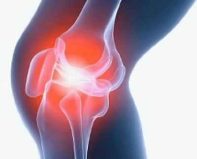 Лечение коленного артроза в одессе thumbnail